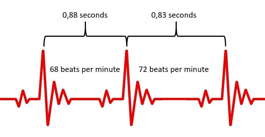 ECG waveform illustration showing the difference between heart rate (beats per minute) and heart rate variability (the variation in time between heartbeats), adapted from Ilmo Strömberg.
