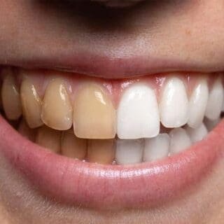 Hidden Stories of Addis Ababa’s Piassa Neighborhood