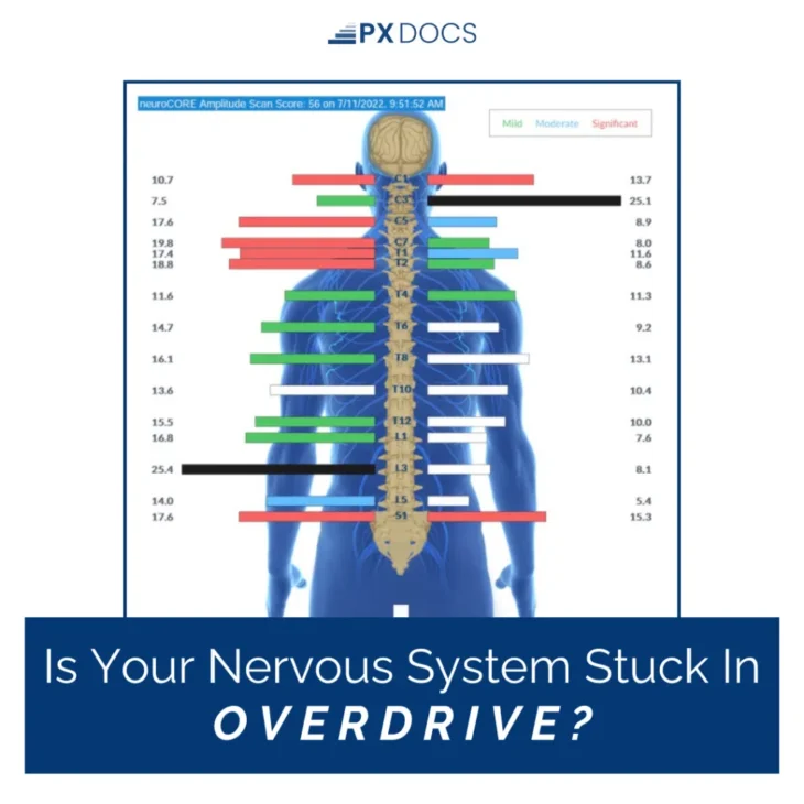 Infographic showing spinal nerve scan readings indicating mild, moderate, and significant nervous system overstimulation levels; showing the necessity of a Soft Reset Day Routine to regulate stress patterns.